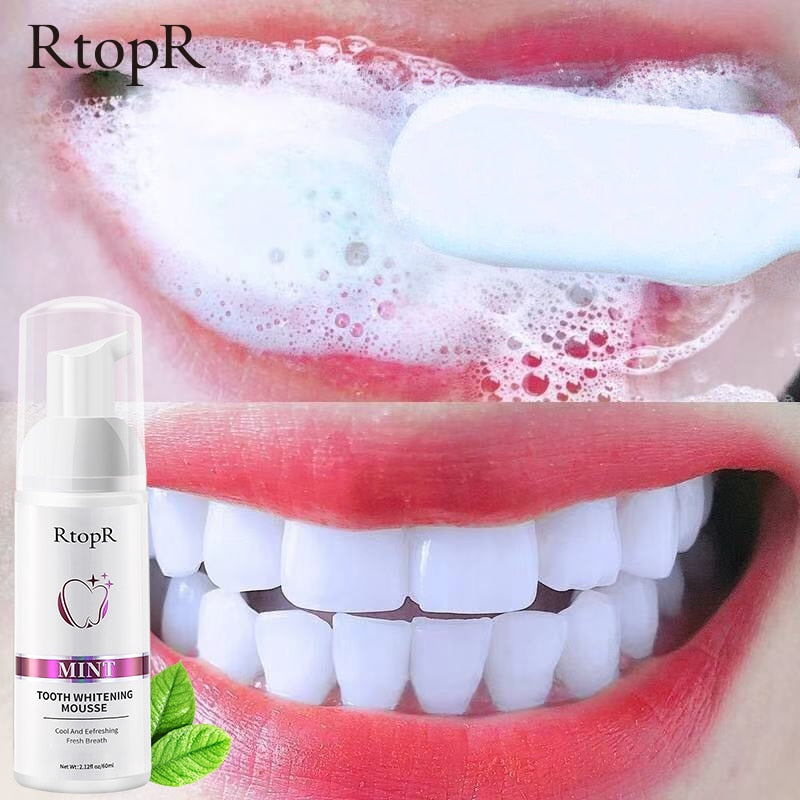 Gentle Teeth Whitening Mousse - Professional Results at Home