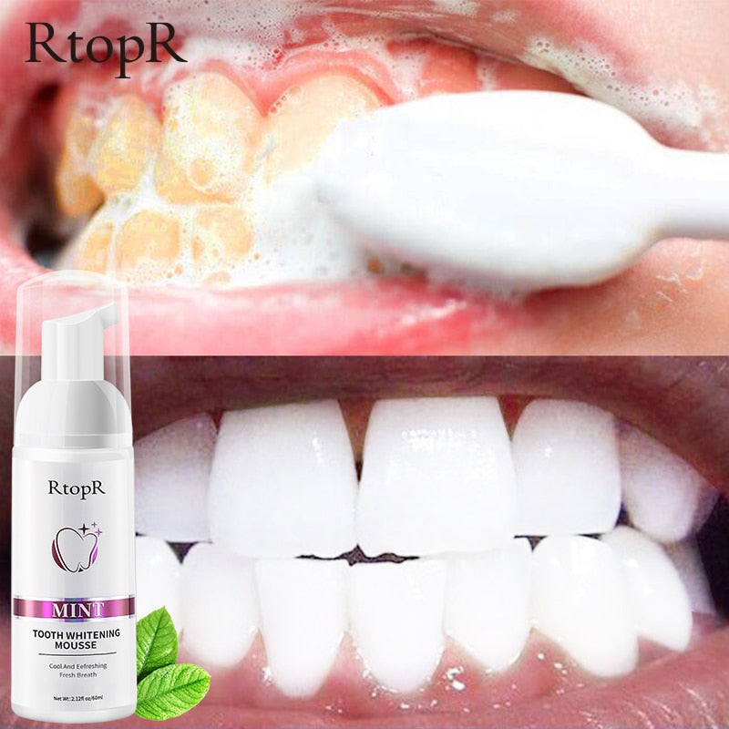 Gentle Teeth Whitening Mousse - Professional Results at Home