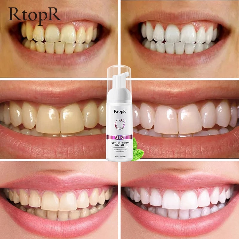 Gentle Teeth Whitening Mousse - Professional Results at Home
