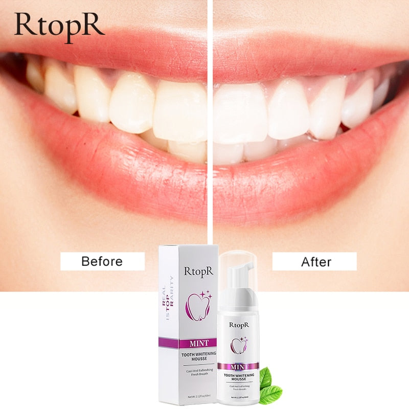 Gentle Teeth Whitening Mousse - Professional Results at Home