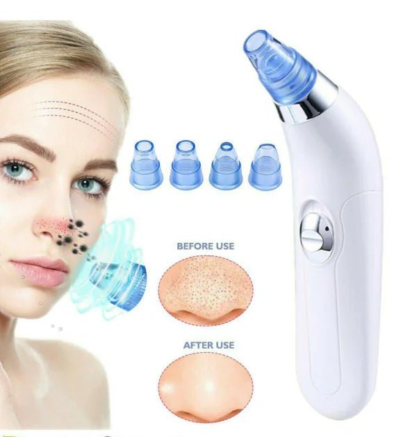 Electric Blackhead Remover Pore Vacuum - Deep Cleansing & Skin Rejuvenation - GNS Beauty & Personal Care