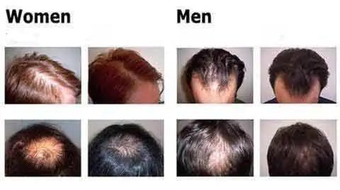 Organic Hair Growth Serum – Natural, Potent & Nourishing Hair Care - GNS Beauty & Personal Care