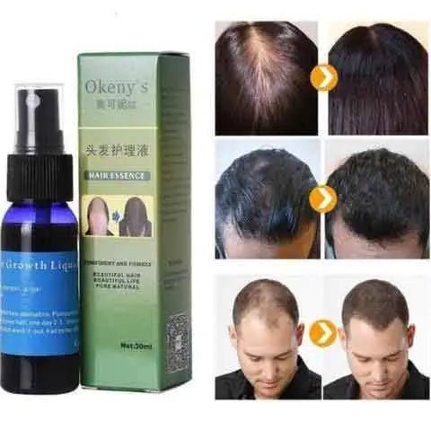 Organic Hair Growth Serum – Natural, Potent & Nourishing Hair Care - GNS Beauty & Personal Care
