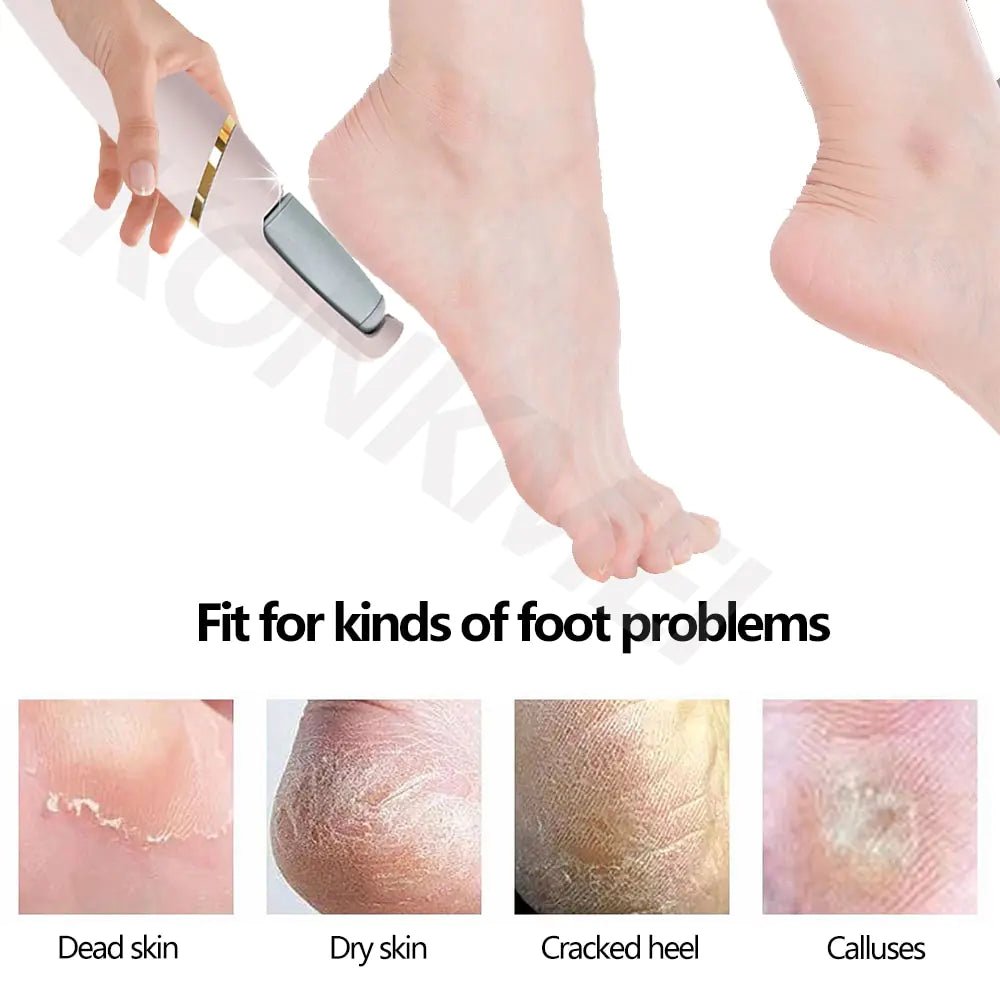 Professional Electric Foot Care Set – Luxury Pedicure Treatment Anytime, Anywhere - GNS Beauty & Personal Care