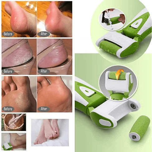 Roll On Sole Foot Spa - All - Natural Quartz Callus Remover & At - Home Pedicure Tool - GNS Beauty & Personal Care