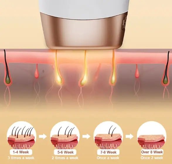 Sensitive Skin Gentle Hair Removal Device - GNS Beauty & Personal Care