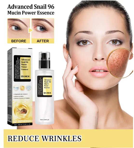Snail Mucin Facial Essence – Hydrate, Repair & Restore Your Skin’s Radiance - GNS Beauty & Personal Care