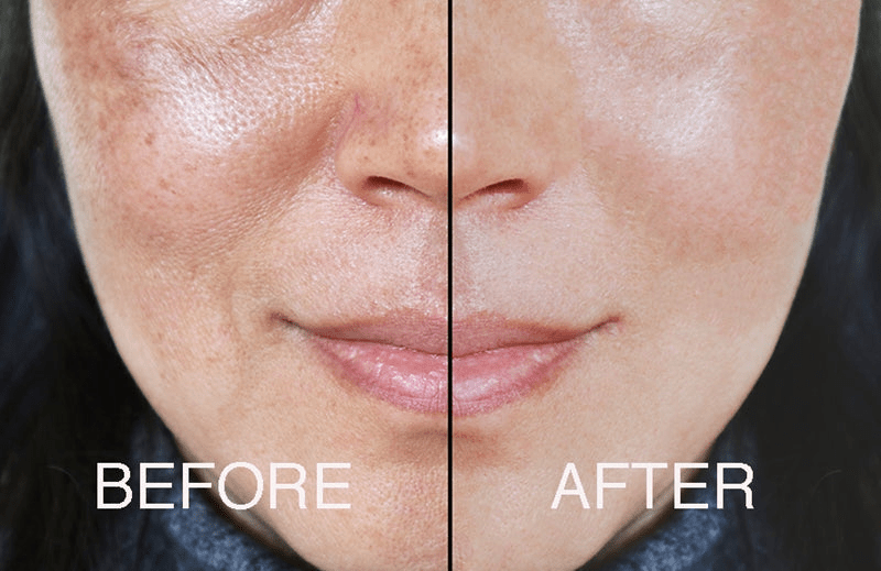π The Complete Fix Youth Serum β Clinical Anti - Aging with Powerful Botanicals - GNS Beauty & Personal Care