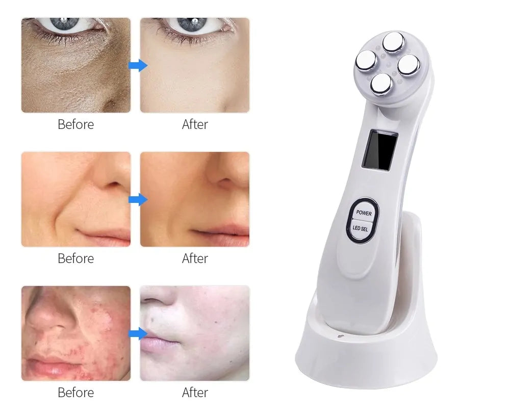 Portable Skincare Massager for Radiant, Youthful Skin