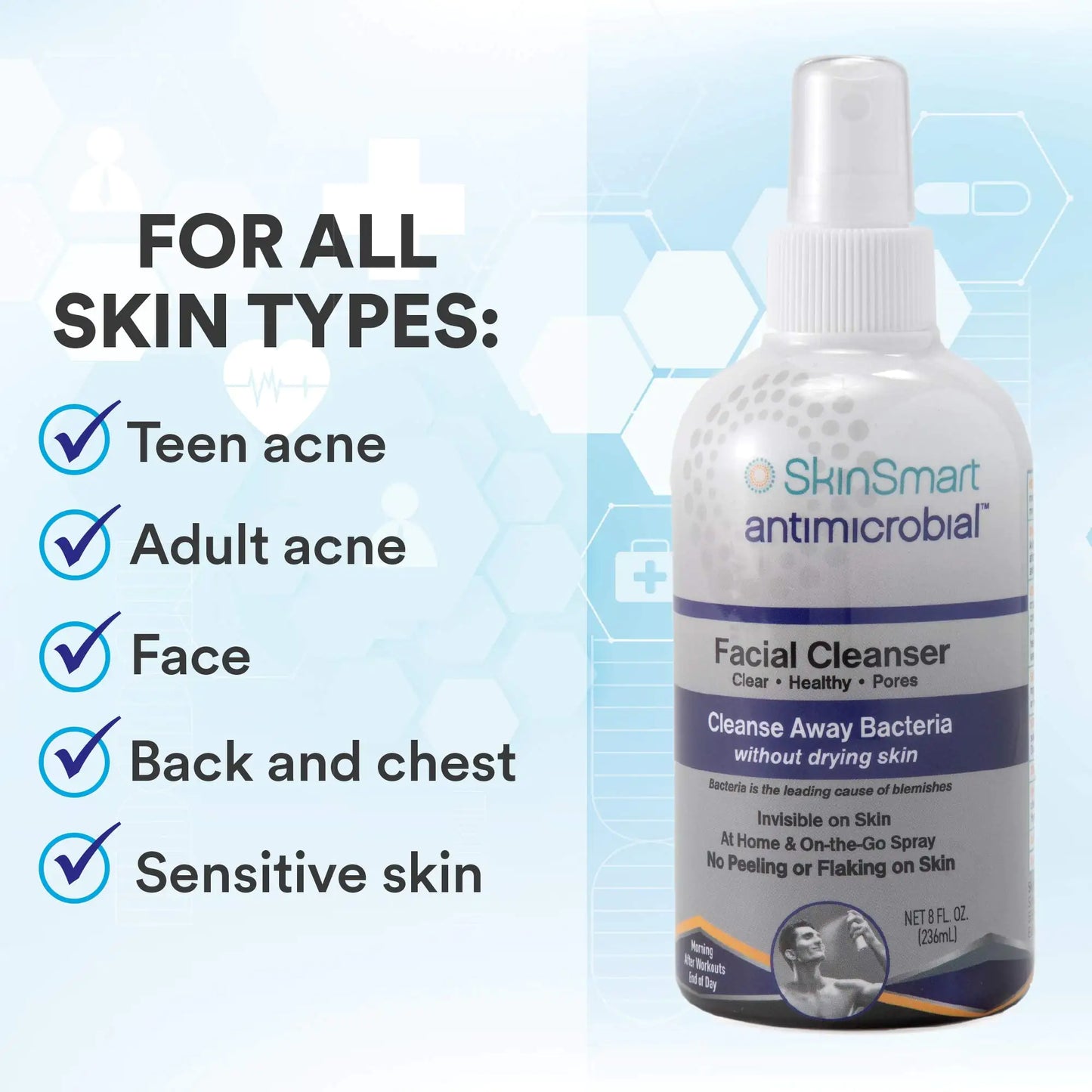 SkinSmart Acne Facial Cleanser - 8 oz Spray, Daily Use