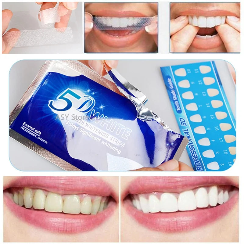 Advanced Teeth Whitening Kit - Professional Bright Smile