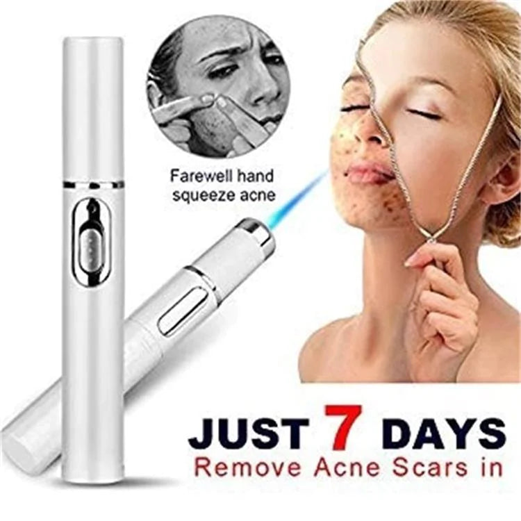 Blue Light Therapy Acne Laser Pen - Scar & Blemish Reduction