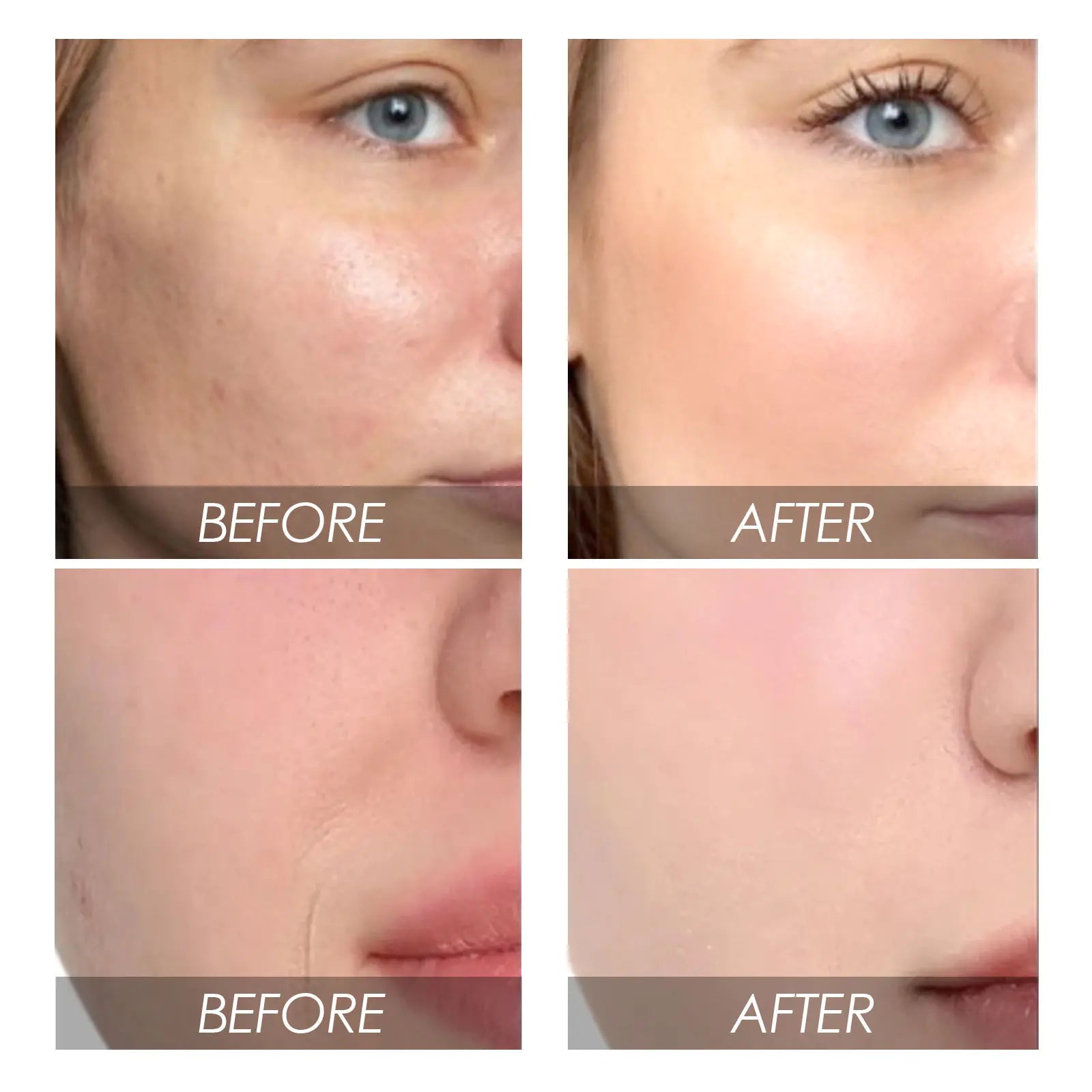 EELHOE Avocado & Watermelon Facial Essence – Hydration, Brightening & Pore Refinement - GNS Beauty & Personal Care
