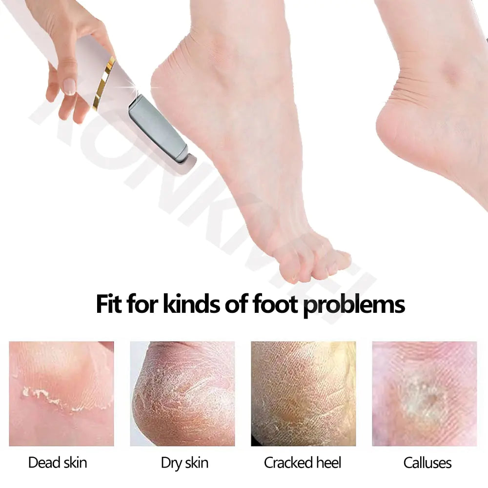Professional Electric Foot Care Set – Luxury Pedicure Treatment Anytime, Anywhere