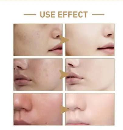 Hydrating Rice Face Toner with Niacinamide and Purslane - 150ml - GNS Beauty & Personal Care