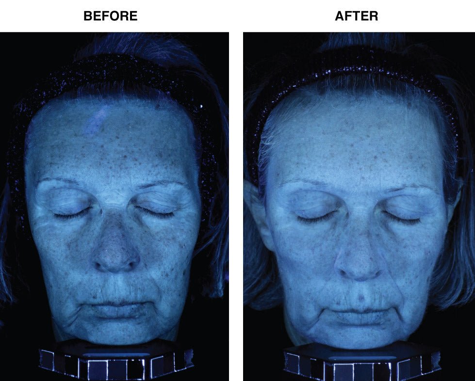 IDEO Skincare Skin Memory Serum - Advanced Anti - Aging Treatment for All 8 Signs of Aging - GNS Beauty & Personal Care