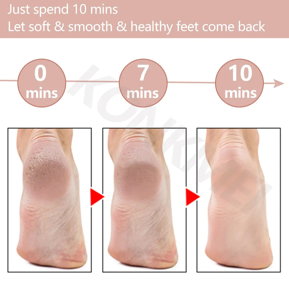 Professional Electric Foot Care Set – Luxury Pedicure Treatment Anytime, Anywhere