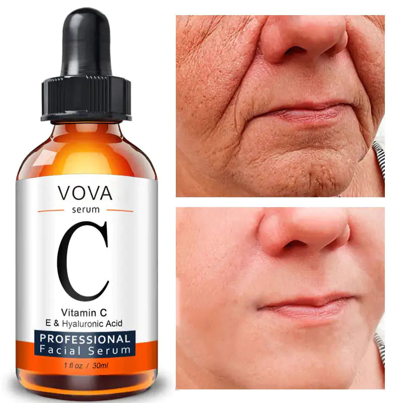 Hyaluronic Acid Anti-Wrinkle Moisturizer with Vitamin C