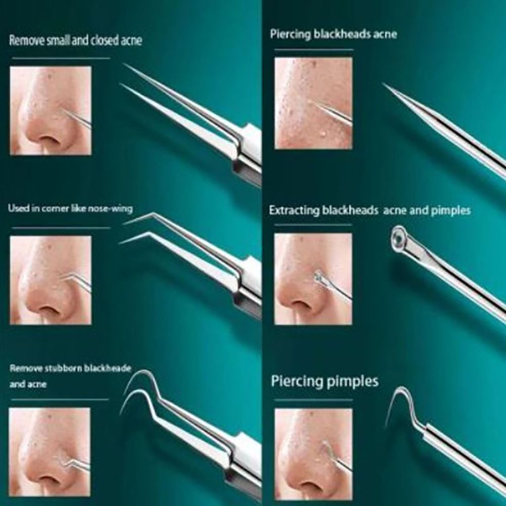 Ultra - Fine 8 - Piece Acne Needle Tool Set - GNS Beauty & Personal Care