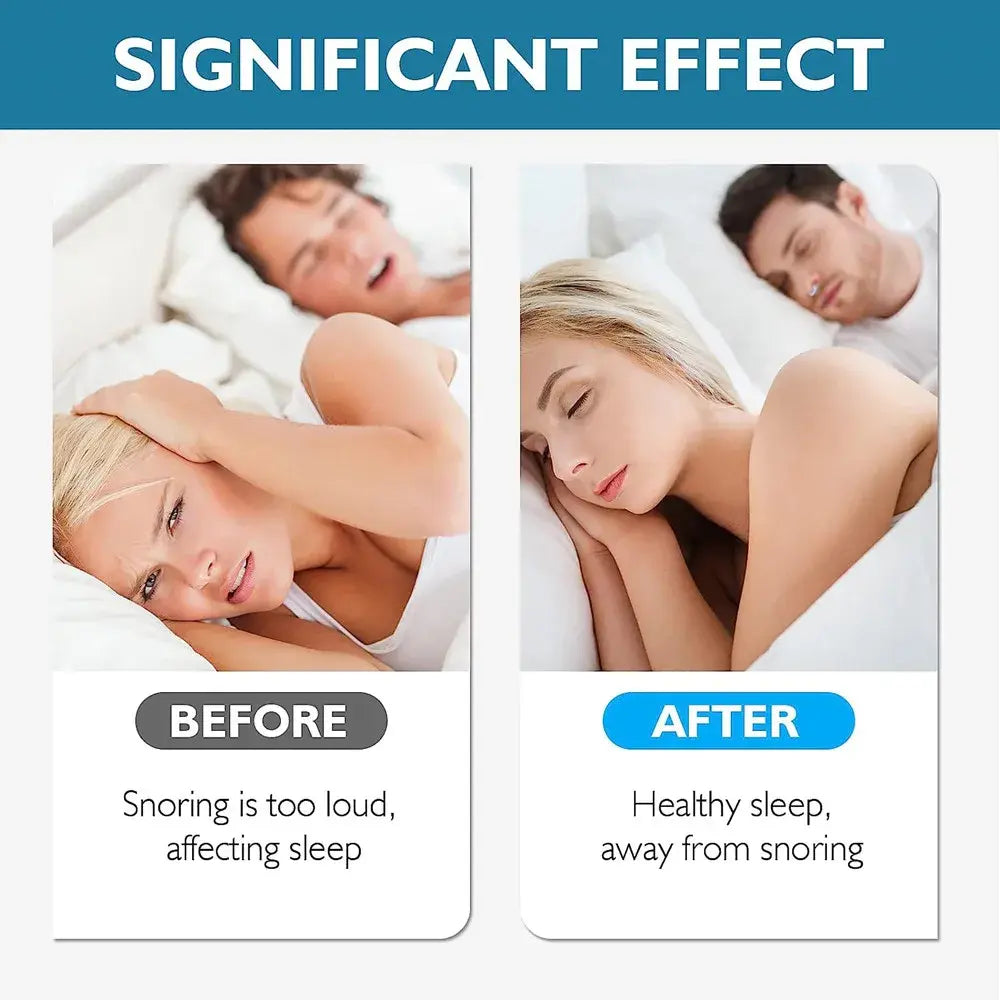 Silicone Magnetic Anti-Snoring Device